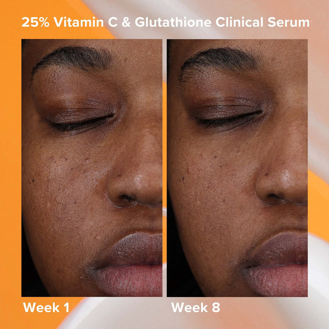 25% Vitamin C+ Glutathione Clinical Serum 30ml - GLAM MODA