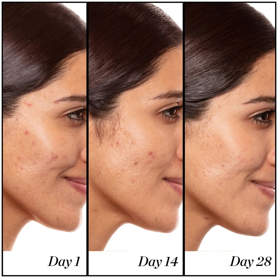 A+ High-Dose Retinoid Serum - GLAM MODA