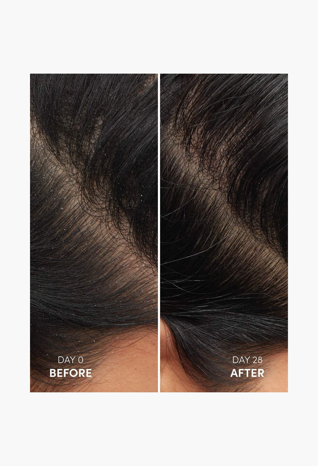 Ouai Anti-Dandruff Hair Shampoo
