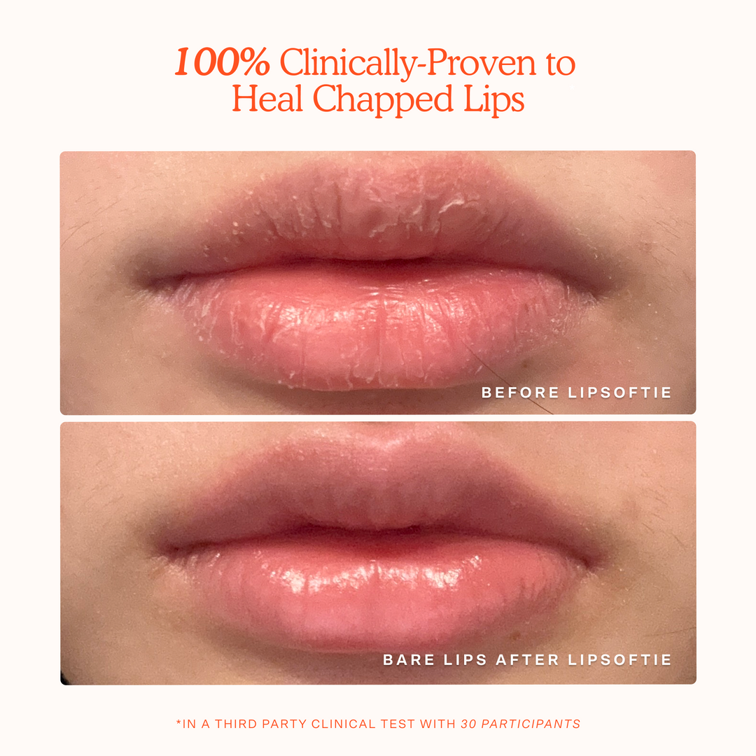 Tower 28 Beauty LipSoftie® Lip Treatment