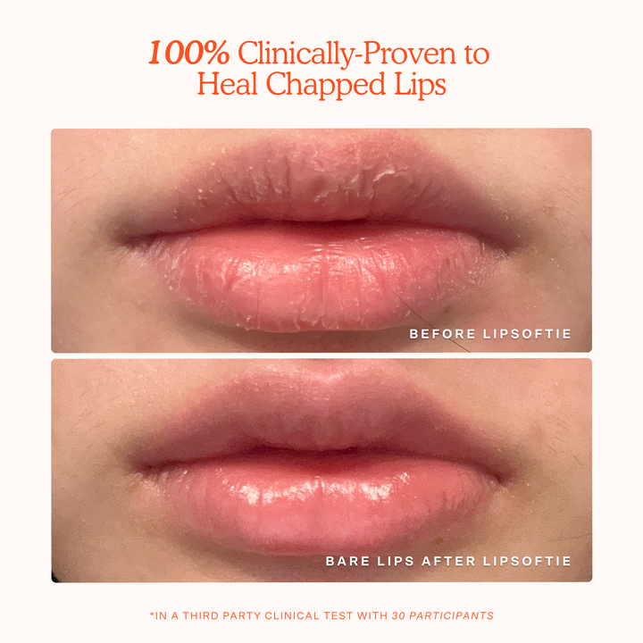 Tower 28 Beauty LipSoftie® Lip Treatment