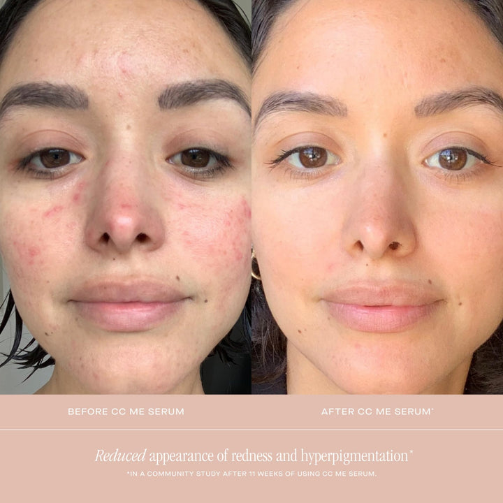 CC Me Serum with Vitamin C + Niacinamide - GLAM MODA