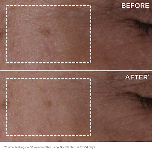 Double Serum Face & Eyes Anti-Aging Skincare Set - GLAM MODA