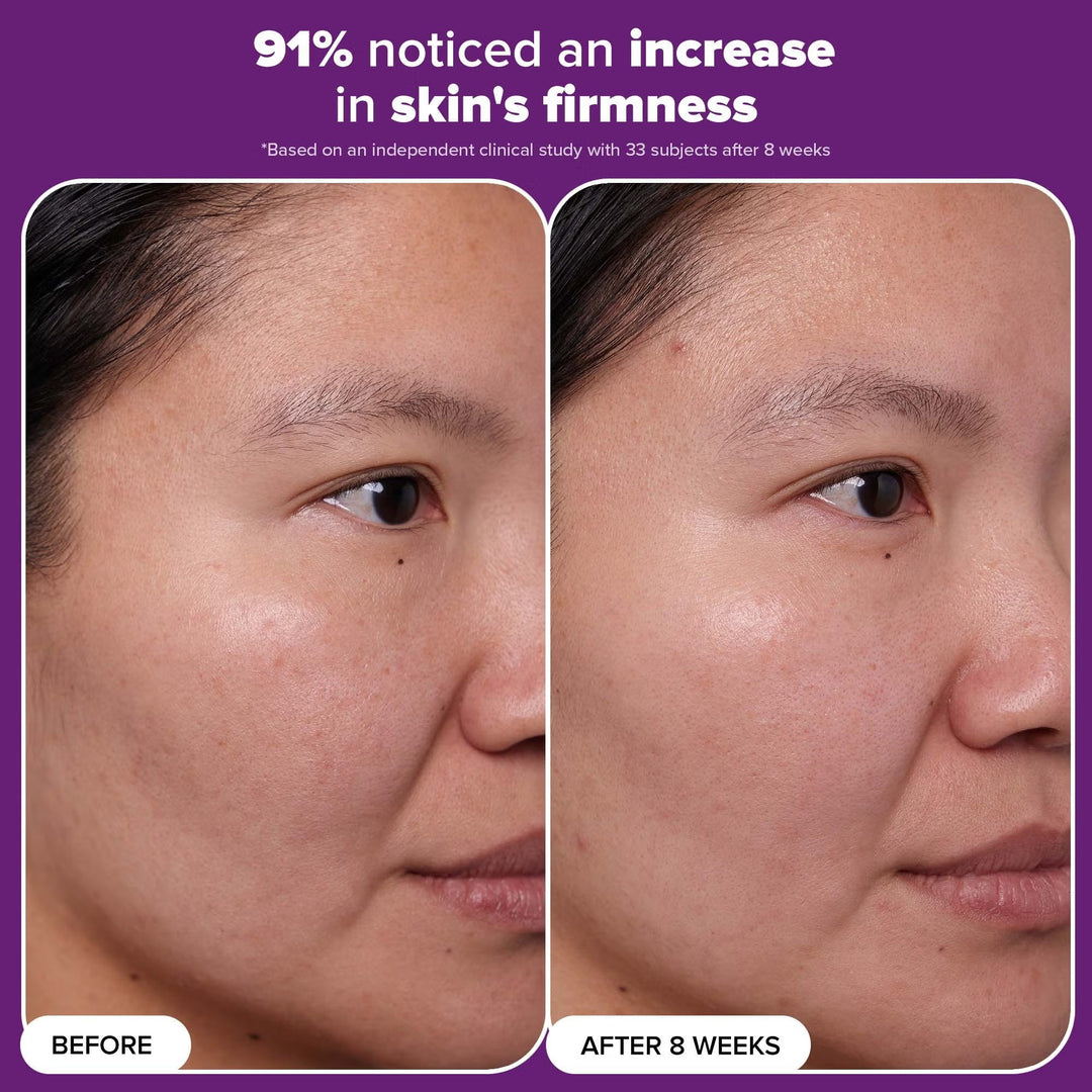 Clinical 1% Retinol Treatment - GLAM MODA