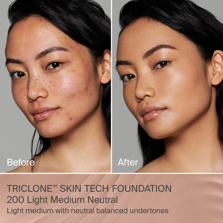 200 Light Medium Neutral - Triclone™ Skin Tech Medium Coverage Foundation - GLAM MODA