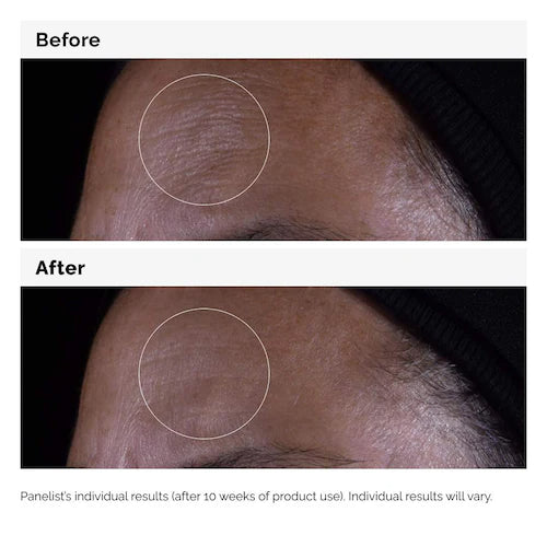 GF 15% Serum for Visible Skin Repair and Wrinkles - GLAM MODA