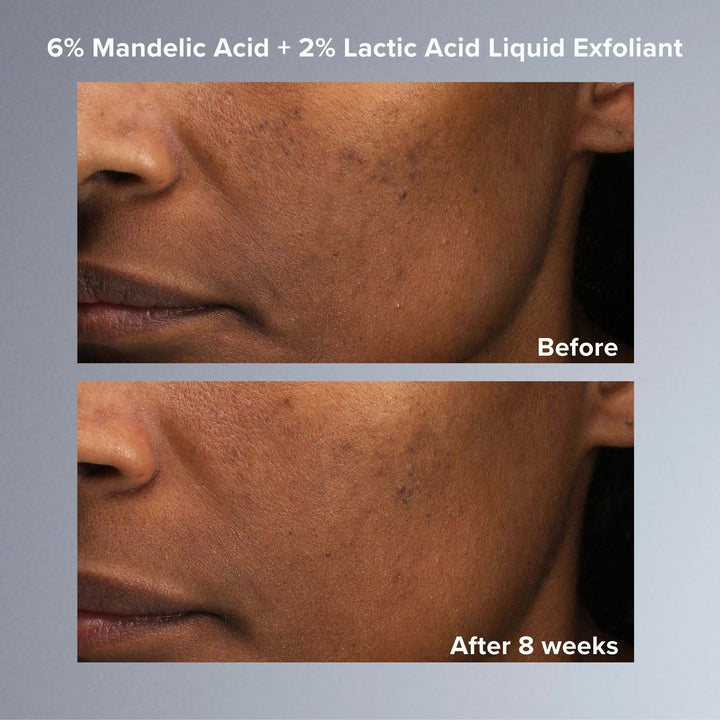 Multi-Level Exfoliation Set - GLAM MODA