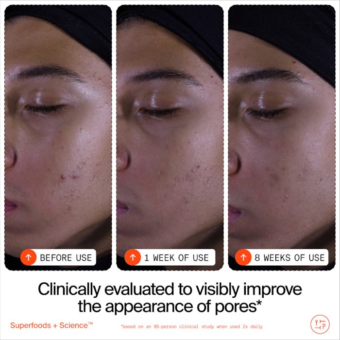 Superfruit Gentle Exfoliating Cleanser with Vitamin C + Papaya - GLAM MODA