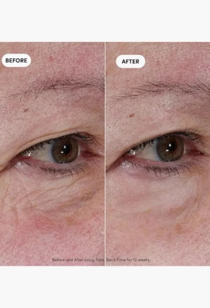 Trinny London Take Back Time Miniprotein Eye Treatment
