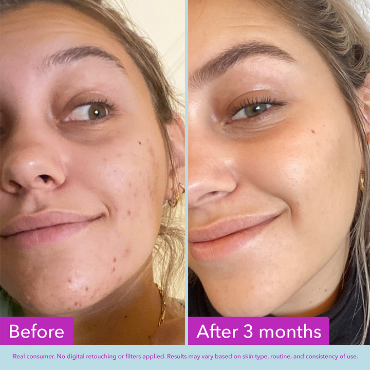 Niacinamide Brightening Toner - GLAM MODA