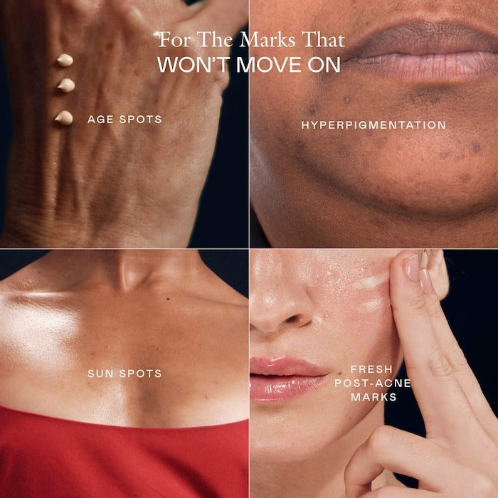 The Mark Advanced Targeted Dark Spot Concentrate with 5% Tranexamic Acid, 1% Alpha Arbutin & 1% Kojic Acid for Hyperpigmentation, Acne Marks & Age Spots - GLAM MODA